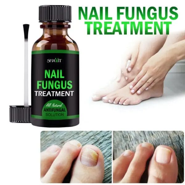 SHAVIT Natural Toenail Fungus Treatment