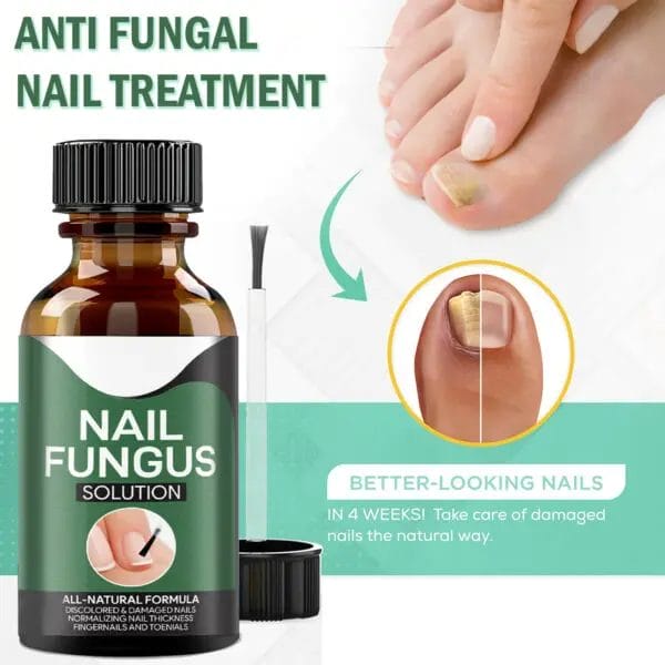 ANTI FUNGAL Toenail Fungus Treatment