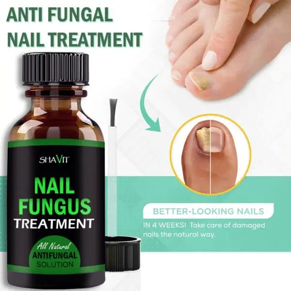 SHAVIT Natural Toenail Fungus Treatment